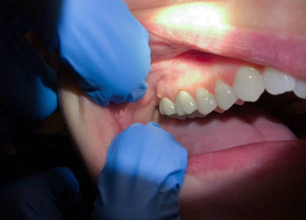 Best Emergency Dental Care for Sports Injuries in Farmersburg, IN