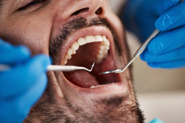 Best Dental Abscess Treatment in Farmersburg, IN